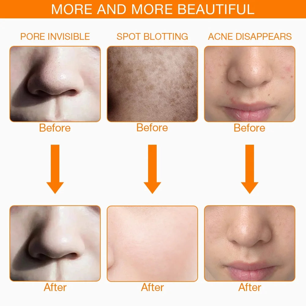 Photon Skin Revive Mask
